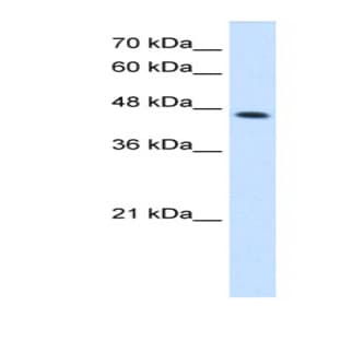 anti-Cystathionase (Cystathionine gamma-Lyase) (CTH) (C-Term) antibody avatar