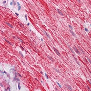 anti-Dishevelled, Dsh Homolog 2 (Drosophila) (DVL2) (N-Term) antibody