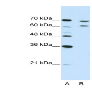 anti-Cleavage and Polyadenylation Specific Factor 3, 73kDa (CPSF3) (N-Term) antibody avatar