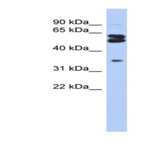 anti-2-Oxoglutarate and Iron-Dependent Oxygenase Domain Containing 1 (OGFOD1) (Middle Region) antibody avatar