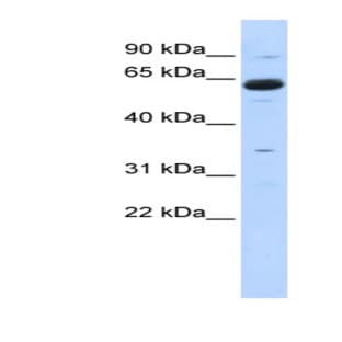 anti-Copine I (CPNE1) (Middle Region) antibody avatar