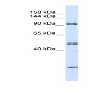 anti-AARS (N-Term) antibody avatar