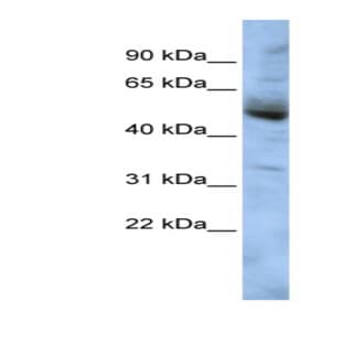 anti-COP9 Constitutive Photomorphogenic Homolog Subunit 4 (Arabidopsis) (COPS4) (Middle Region) antibody avatar