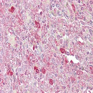 anti-Activating Transcription Factor 1 (AFT1) (C-Term) antibody avatar