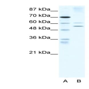 anti-Autoimmune Regulator (AIRE) (N-Term) antibody avatar