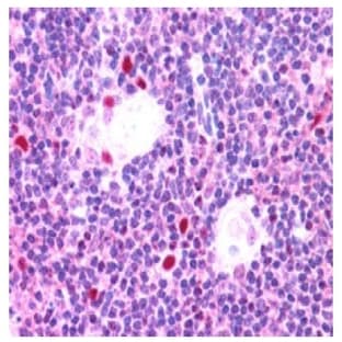 anti-Autoimmune Regulator (AIRE) (Internal Region), (Isoform 1) antibody avatar