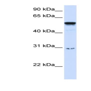 anti-Autoimmune Regulator (AIRE) (Middle Region) antibody avatar