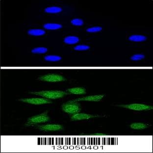 anti-Autoimmune Regulator (AIRE) (AA 64-92), (Center) antibody avatar