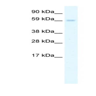 anti-Autoimmune Regulator (AIRE) (N-Term) antibody avatar
