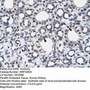 anti-Autoimmune Regulator (AIRE) (N-Term) antibody avatar