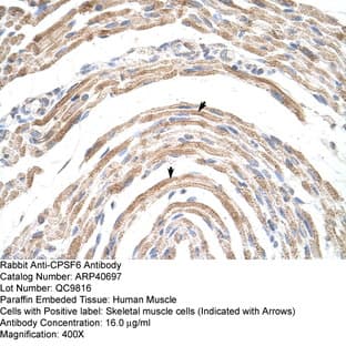 anti-Cleavage and Polyadenylation Specific Factor 6, 68kDa (CPSF6) (Middle Region) antibody avatar