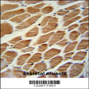 anti-Acyl-CoA Dehydrogenase, Long Chain (ACADL) (AA 292-319), (Center) antibody avatar