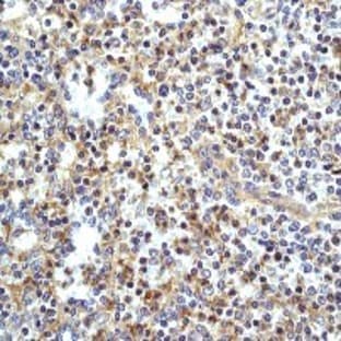 anti-Baculoviral IAP Repeat Containing 3 (BIRC3) antibody avatar