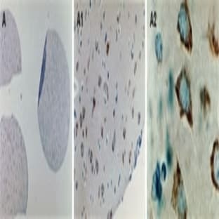 anti-Baculoviral IAP Repeat Containing 3 (BIRC3) (AA 152-172) antibody avatar