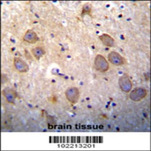 anti-Baculoviral IAP Repeat Containing 3 (BIRC3) (N-Term), (AA 101-131) antibody avatar