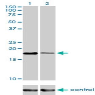 anti-Baculoviral IAP Repeat-Containing 5 (BIRC5) (AA 1-101) antibody avatar