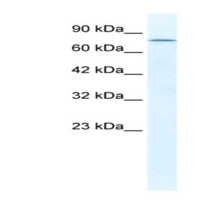 anti-DEAD (Asp-Glu-Ala-Asp) Box Polypeptide 23 (DDX23) (C-Term) antibody avatar