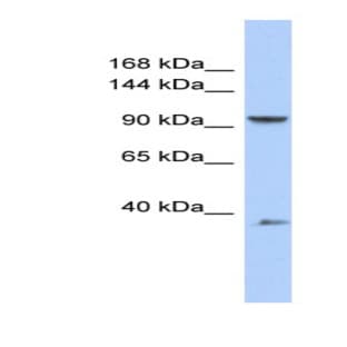 anti-Adaptor-Related Protein Complex 2, beta 1 Subunit (AP2B1) (Middle Region) antibody avatar