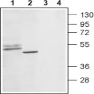anti-5-Hydroxytryptamine Receptor 1D (N-Term), (AA 14-27), (Extracellular Loop) antibody