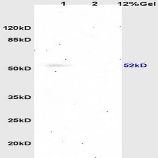 anti-5-Hydroxytryptamine (serotonin) Receptor 2A, G Protein-Coupled (HTR2A) antibody