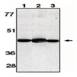 anti-Caspase 13, Apoptosis-Related Cysteine Protease (CASP13) (AA 91-105) antibody