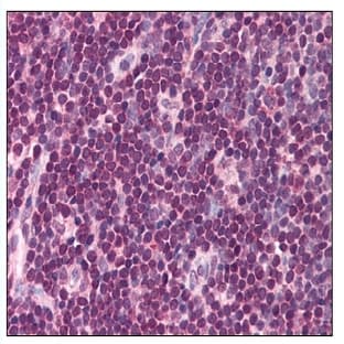 anti-Interferon Regulatory Factor 8 (IRF8) (C-Term) antibody avatar