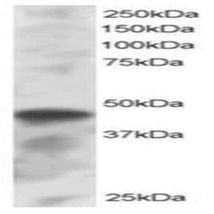 anti-Interferon Regulatory Factor 8 (IRF8) (C-Term) antibody avatar