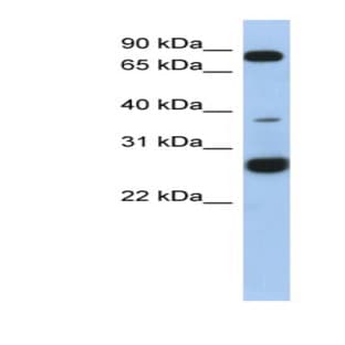 anti-Chromosome 1 Open Reading Frame 110 (C1ORF110) (N-Term) antibody avatar