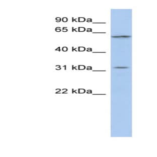 anti-Chromosome 1 Open Reading Frame 110 (C1ORF110) (Middle Region) antibody avatar