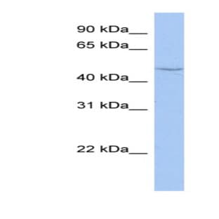 anti-Cytochrome P450, Family 27, Subfamily C, Polypeptide 1 (CYP27C1) (Middle Region) antibody avatar