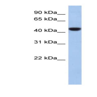 anti-Chromosome 2 Open Reading Frame 53 (C2orf53) (Middle Region) antibody avatar