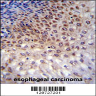 anti-Coiled-Coil Domain Containing 36 (CCDC36) (C-Term), (AA 422-450) antibody avatar