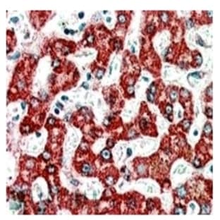 anti-Acyl-CoA Dehydrogenase, C-4 To C-12 Straight Chain (ACADM) (C-Term) antibody avatar