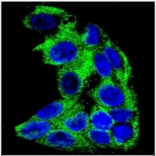 anti-Acyl-CoA Dehydrogenase, C-4 To C-12 Straight Chain (ACADM) (AA 196-225) antibody avatar