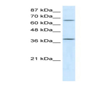 anti-Acyl-CoA Dehydrogenase, C-4 To C-12 Straight Chain (ACADM) (N-Term) antibody avatar