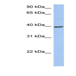 anti-Acyl-CoA Dehydrogenase, C-4 To C-12 Straight Chain (ACADM) (N-Term) antibody avatar