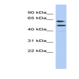 anti-Chromosome X Open Reading Frame 67 (CXorf67) (Middle Region) antibody avatar