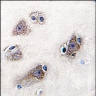 anti-Cytochrome P450, Family 26, Subfamily C, Polypeptide 1 (CYP26C1) (C-Term) antibody avatar