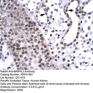 anti-BarH-Like Homeobox 2 (BARHL2) (Middle Region) antibody