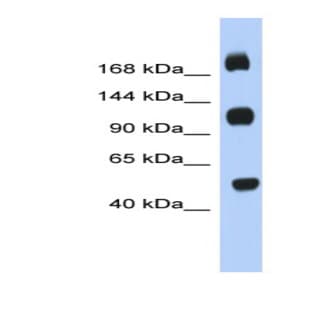 anti-Chromosome 2 Open Reading Frame 55 (C2orf55) (Middle Region) antibody avatar