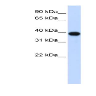 anti-Cyclin-Dependent Kinase 1 (CDK1) (Middle Region) antibody avatar