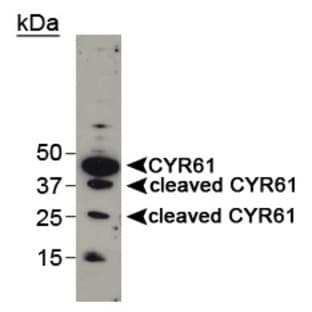 anti-Cysteine-Rich, Angiogenic Inducer, 61 (CYR61) (AA 250-350) antibody avatar
