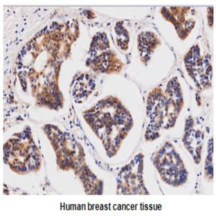 anti-Cysteine-Rich, Angiogenic Inducer, 61 (CYR61) (AA 168-242) antibody avatar