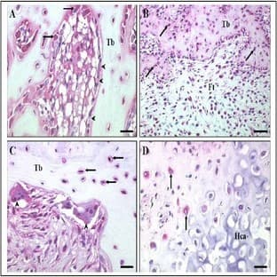 anti-Cysteine-Rich, Angiogenic Inducer, 61 (CYR61) antibody avatar