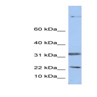anti-15 KDa Selenoprotein (SEP15) (Middle Region) antibody avatar