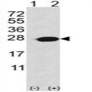 anti-Adenine Phosphoribosyltransferase (APRT) (C-Term) antibody avatar
