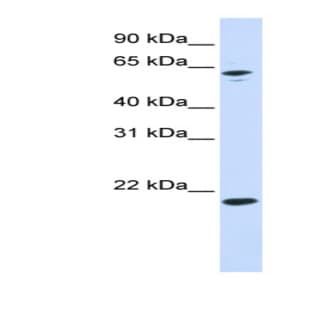 anti-Adenine Phosphoribosyltransferase (APRT) (N-Term) antibody avatar