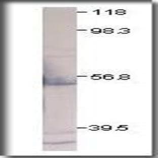 anti-Chemokine (C-X-C Motif) Receptor 2 (CXCR2) antibody avatar