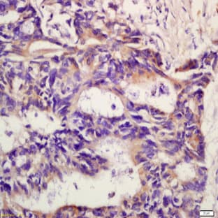 anti-Chemokine (C-X-C Motif) Receptor 2 (CXCR2) antibody avatar