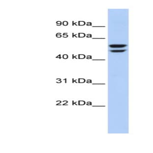 anti-ATPase, H+ Transporting, Lysosomal 56/58kDa, V1 Subunit B2 (ATP6V1B2) (N-Term) antibody avatar
